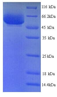 Shigella flexneri ipaH9.8 / Invasion Plasmid Ant Protein (Recombinant His)