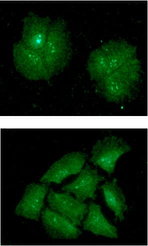 IMP3 Antibody (clone AT32E9)