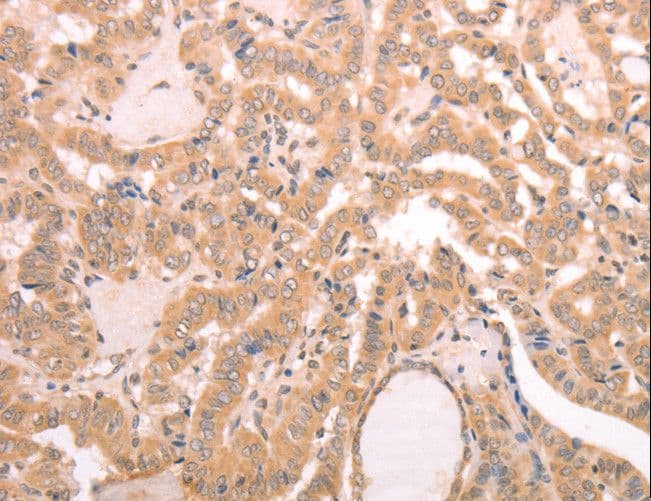 Polyclonal Rabbit anti-Human AASDHPPT / LYS5 Antibody (IHC, WB)