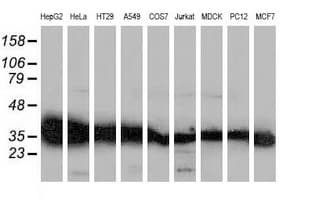 GALE / UDP-Glucose 4-Epimerase Antibody (clone OTI1C4)