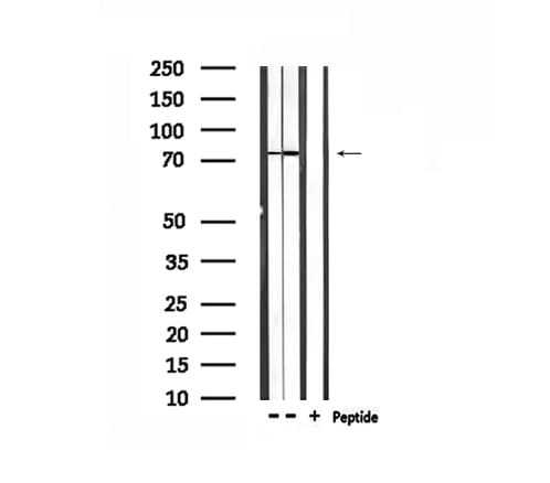 Polyclonal Rabbit anti-Human TICAM1 / TRIF Antibody (IHC, WB)