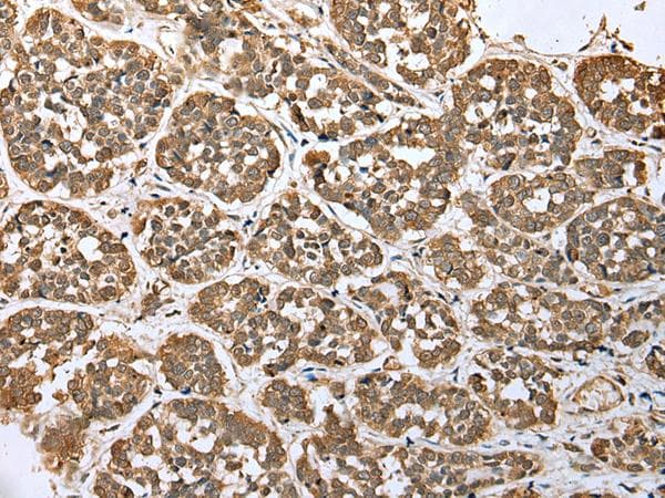 Polyclonal Rabbit anti-Human ATXN7L3 Antibody (IHC, WB)