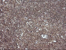 MAP2K1 / MKK1 / MEK1 Antibody (clone OTI2G5, Carrier-free)