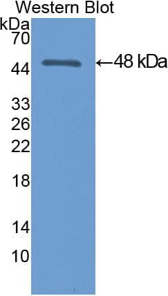 ENO3 / Enolase 3 Antibody (aa3-434)