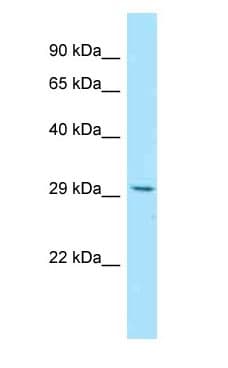 RWDD3 Antibody (aa92-141)