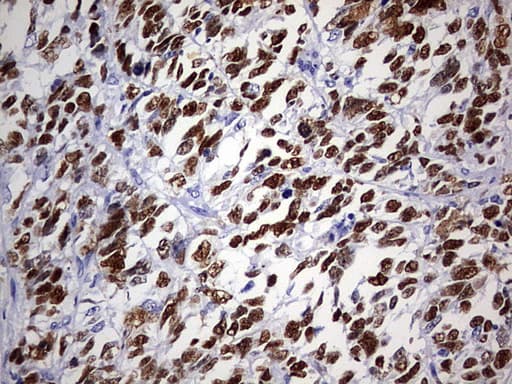 TP53 / p53 Antibody (clone OTI9A7)