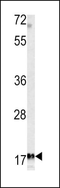 MFAP5 / MAGP2 Antibody (aa133-160)