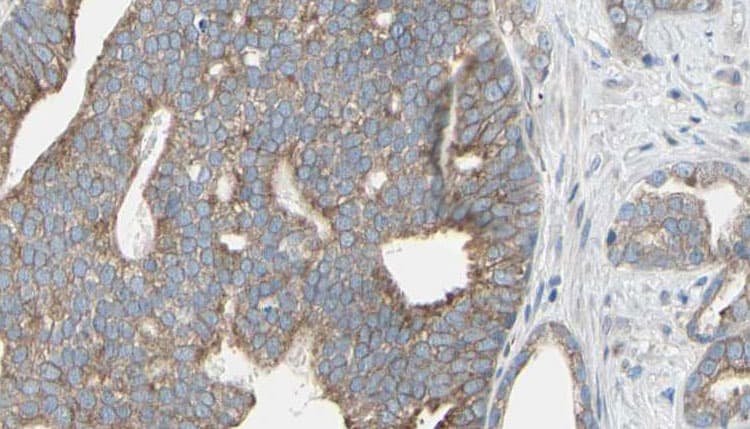 KIAA0652 / ATG13 Antibody