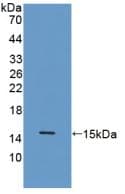 Procalcitonin Antibody (Biotin)