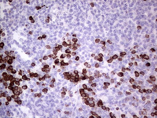 GLI / GLI1 Antibody (aa1-410, clone UMAB170)