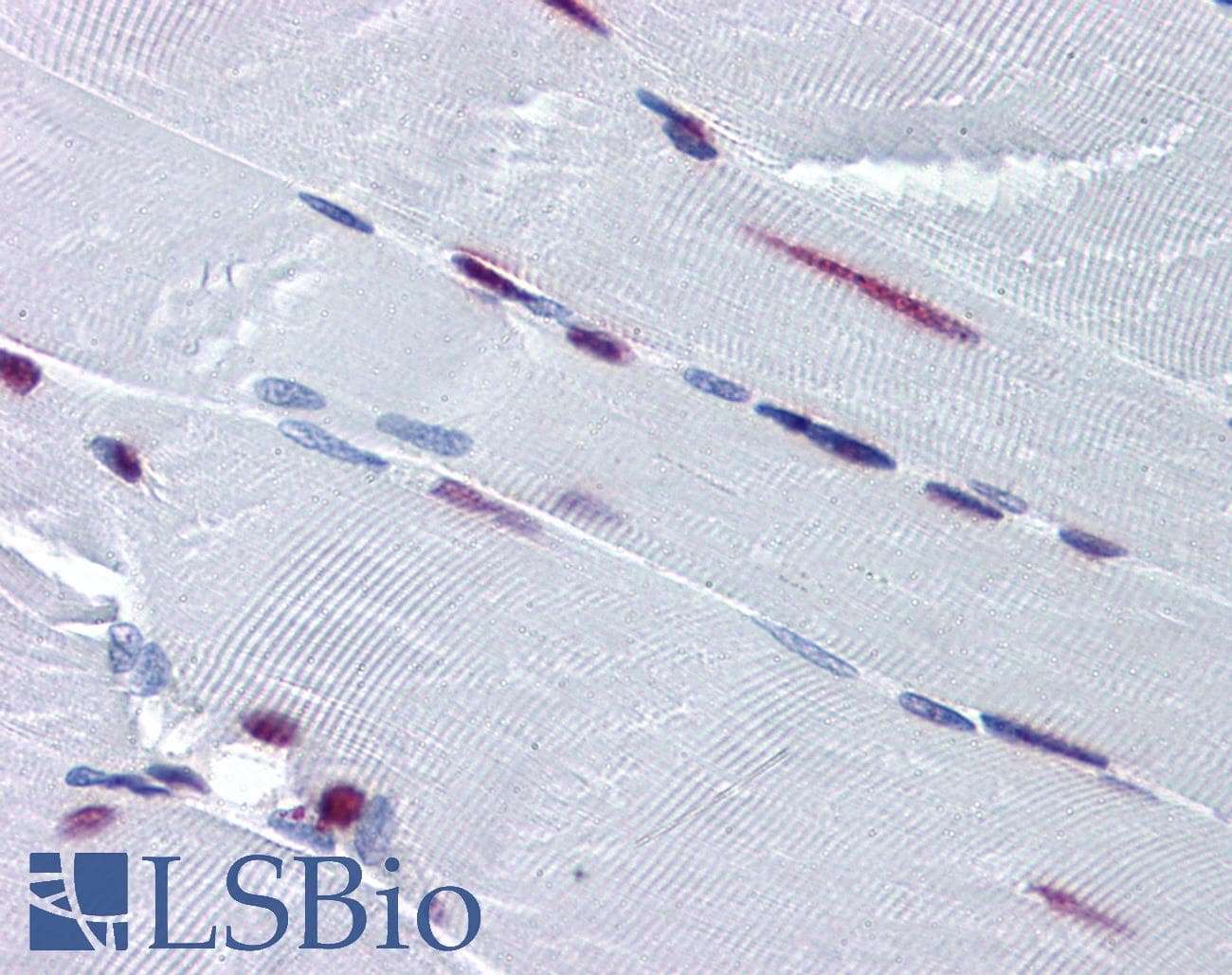 PathPlus™ Monoclonal Mouse anti-Human SF1 Antibody (clone 2E12, IHC, IF, WB)
