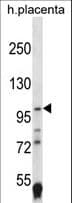 HIF2A / EPAS1 Antibody (aa577-605)