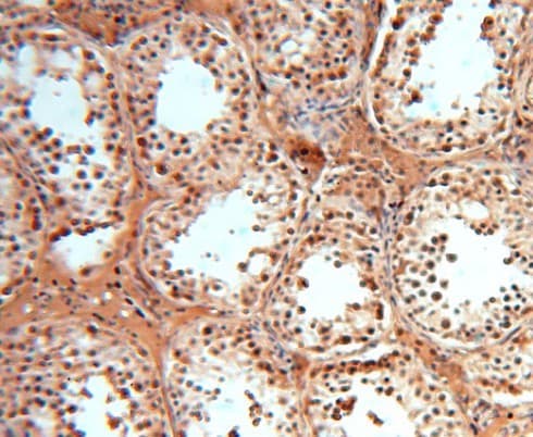 Polyclonal Rabbit anti-Human SOD1 / Cu-Zn SOD Antibody (IHC, WB)