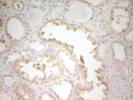 Monoclonal Mouse anti-Human S100A1 / S100-A1 Antibody (clone OTI7B11, IHC, WB)
