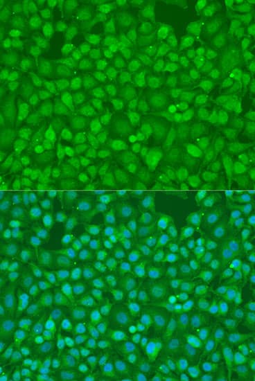 SMAD7 Antibody