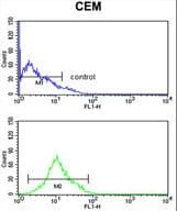KCNJ11 / Kir6.2 Antibody (aa1-30)