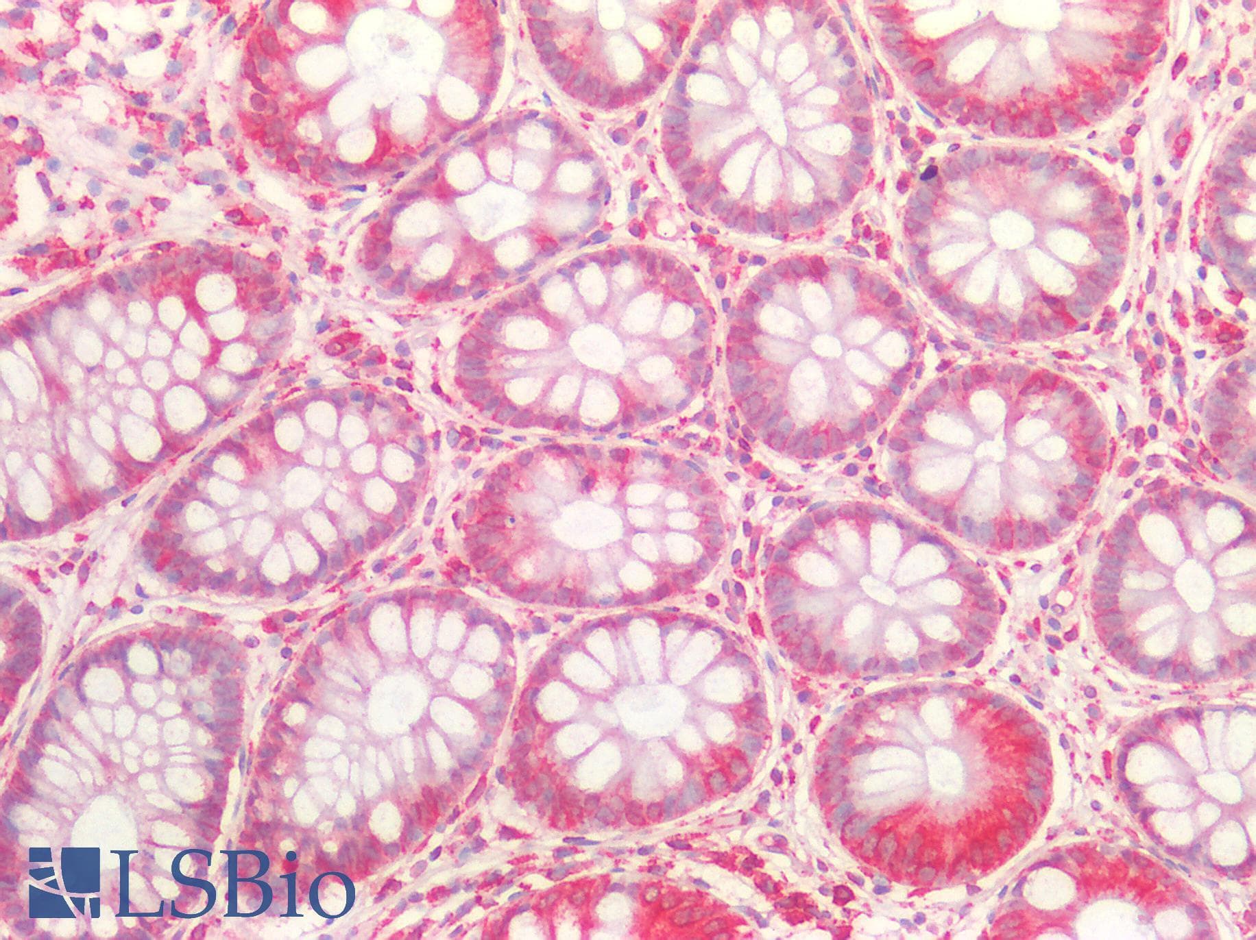 IHC-plus™ ZFP91 Antibody