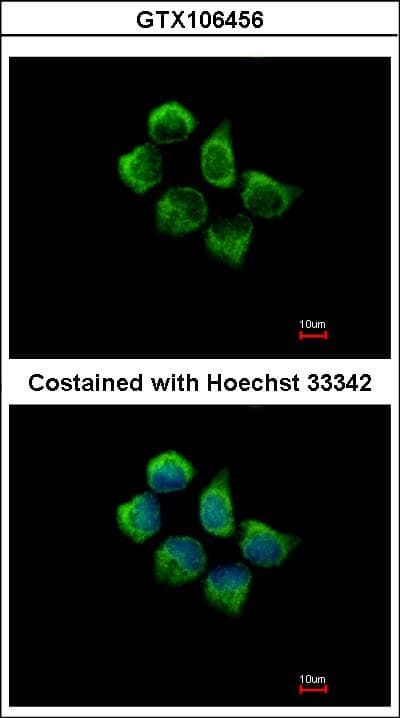 SNX12 Antibody (aa100-112)
