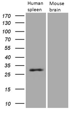 PRTN3 / Myeloblastin Antibody (aa28-248, clone OTI9C2)