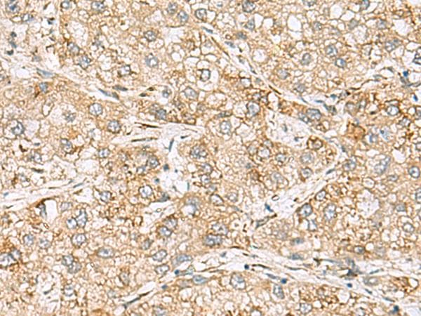 SH3GL2 Antibody