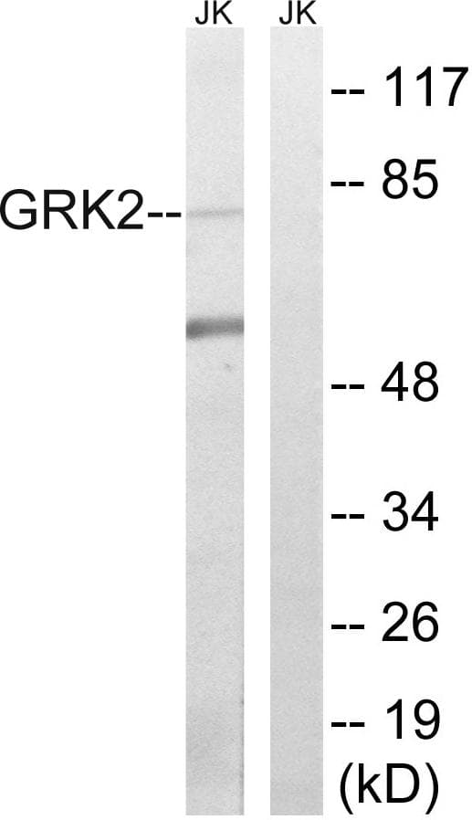 Polyclonal Rabbit anti-Human ADRBK1 / GRK2 Antibody (Ab-685, IHC, WB)