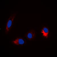 Polyclonal Rabbit anti-Human MAPT / Tau Antibody (C-Terminus, IHC, IF, WB)