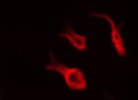 HTR5A / 5-HT5A Receptor Antibody
