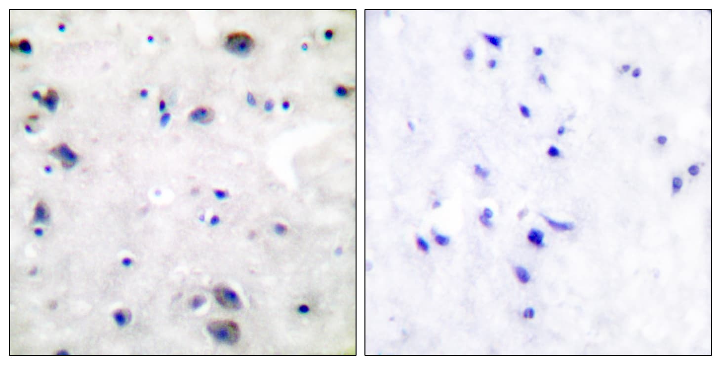 OPRM1 / Mu Opioid Receptor Antibody (aa341-390)
