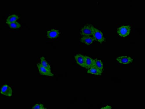 TNFSF11 / RANKL / TRANCE Antibody