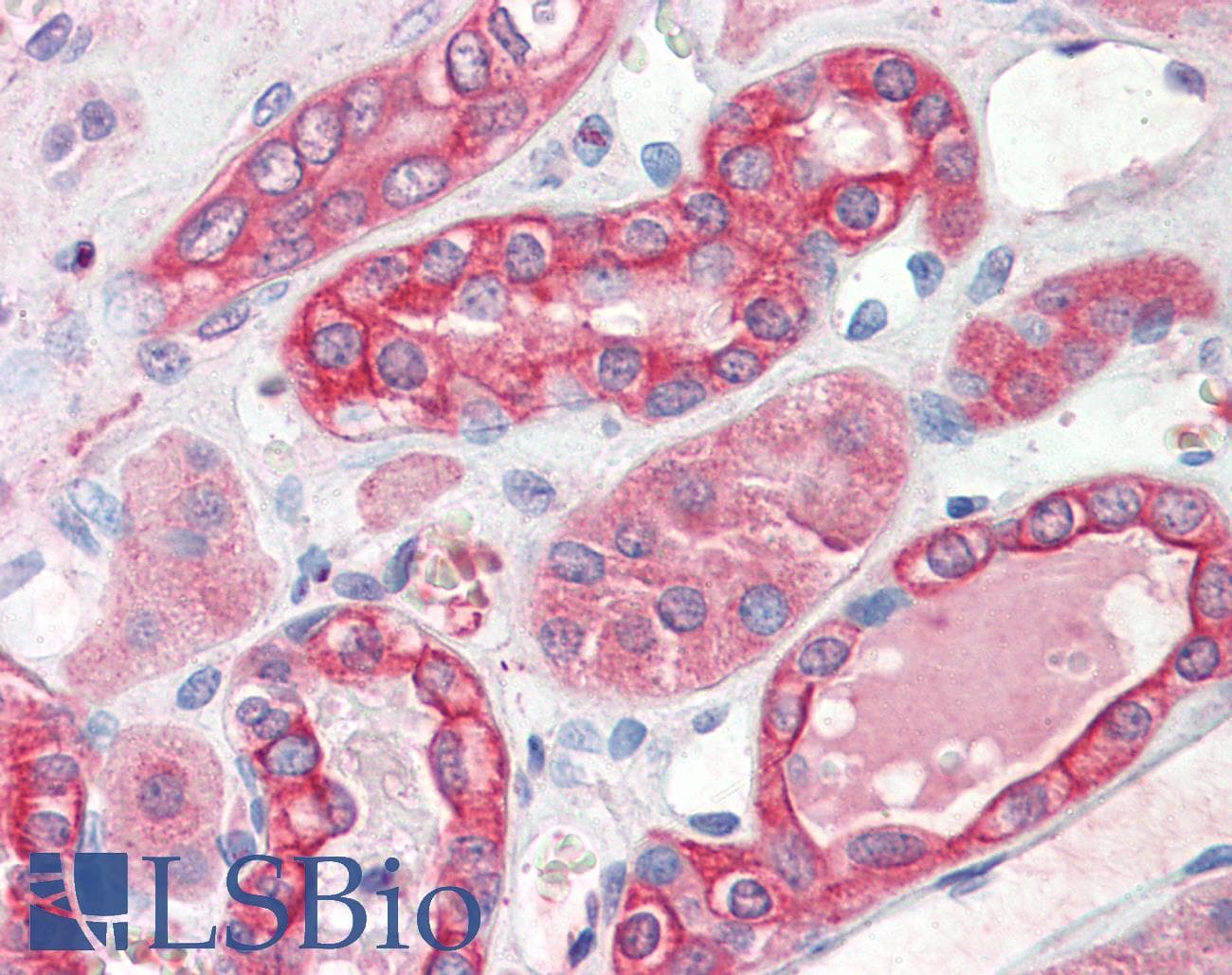 IHC-plus™ TS / Thymidylate Synthase Antibody