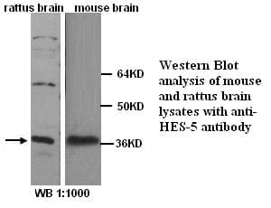 IHC-plus™ HES5 Antibody (Internal)