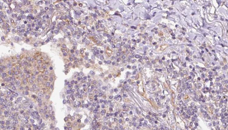 RAP1B Antibody