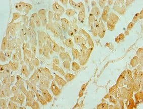 Polyclonal Rabbit anti-Human ASAH1 / Acid Ceramidase Antibody (aa146-395, IHC, WB)