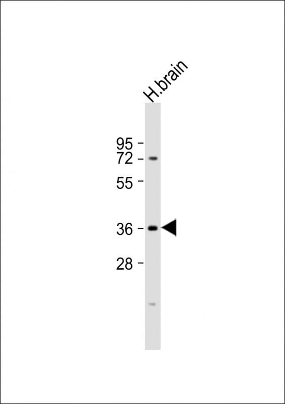 Polyclonal Rabbit anti-Human NMNAT1 / NMNAT Antibody (aa171-201, WB)