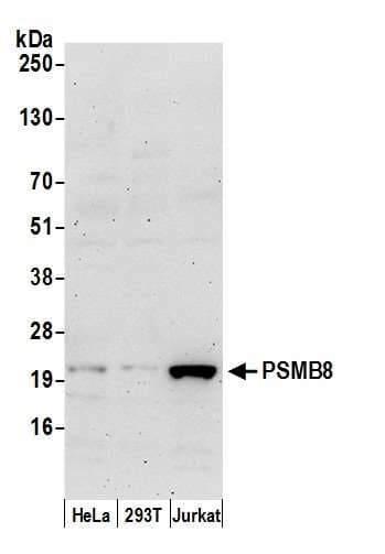 PSMB8 / LMP7 Antibody (aa125-175)