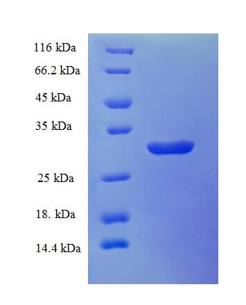Arabidopsis thaliana WRKY2 Protein (Recombinant His)