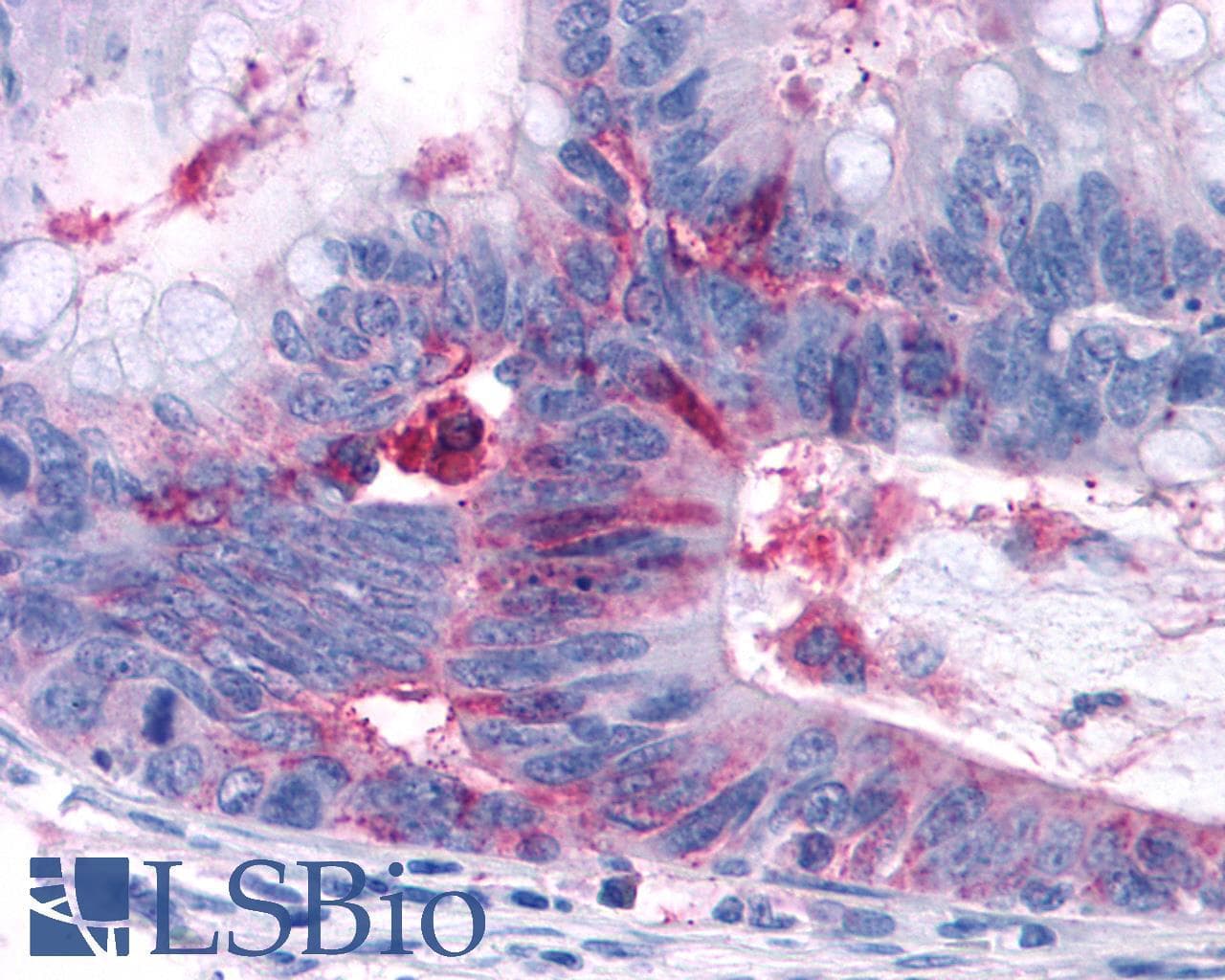 IHC-plus™ Polyclonal Rabbit anti-Human GPRC5A / RAI3 Antibody (Cytoplasmic Domain, IHC)