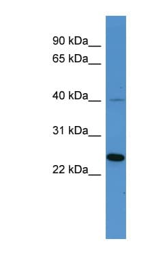Polyclonal Rabbit anti-Human MRGPRX3 / MRGX3 Antibody (aa244-293, WB)