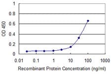 ADK / Adenosine Kinase Antibody (clone 4E7)