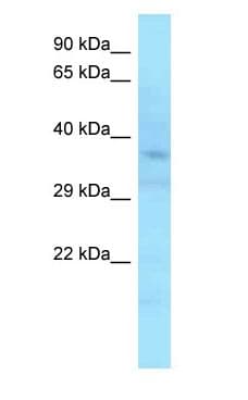 APOL6 / Apolipoprotein L 6 Antibody (C-Terminus)