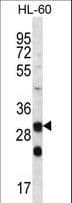 CA6 / Carbonic Anhydrase 6 Antibody (aa238-267)