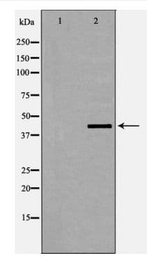 DMTN / Dematin Antibody (phospho-Ser403)