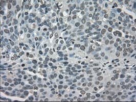 Monoclonal Mouse anti-Human LDHA / LDH1 Antibody (clone OTI2D11, IHC, WB)