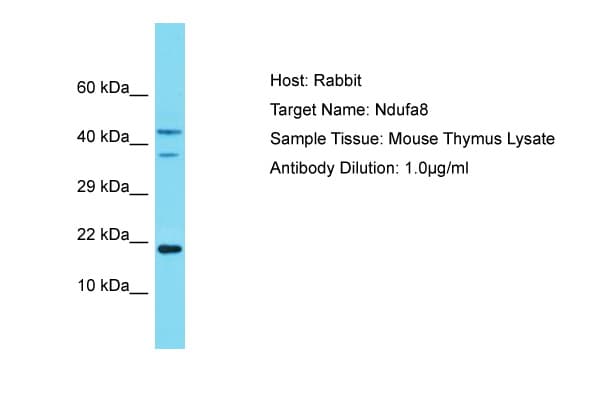 NDUFA8 Antibody (aa41-90)