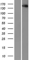 IKBKAP / IKAP Protein (Over-Expression Lysate Myc-DDK (Flag))