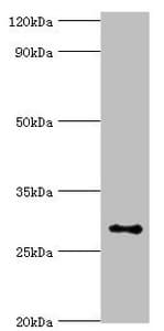 ABH2 / ALKBH2 Antibody (aa1-261)