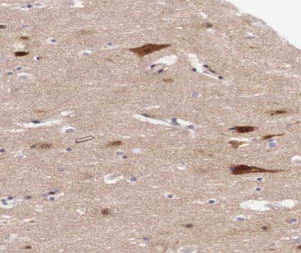 RB1 / Retinoblastoma / RB Antibody (phospho-Ser795)