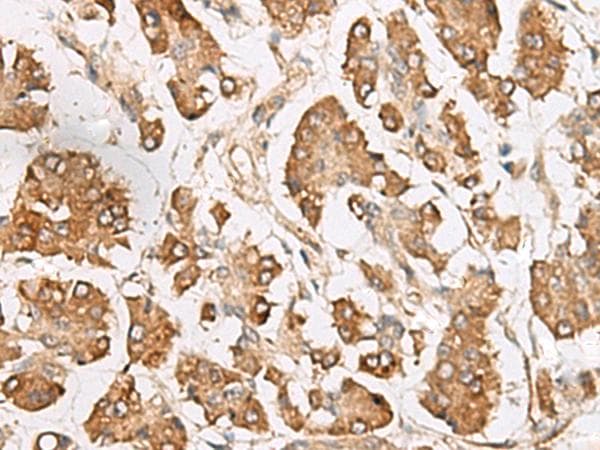 SLC40A1 / Ferroportin-1 Antibody