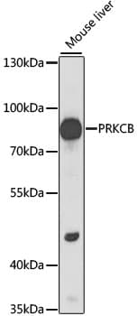 PRKCB / PKC-Beta Antibody
