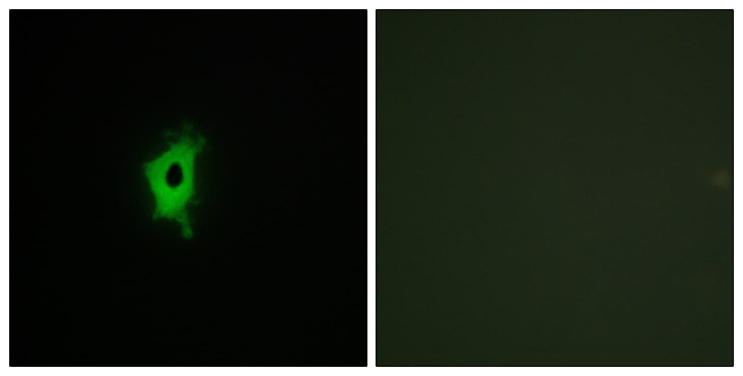 Polyclonal Rabbit anti-Human LGALS2 / Galectin 2 Antibody (aa31-80, IHC, IF)